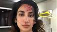 Parul Gulati Unveils Intense Look for Upcoming Murder Mystery Series!