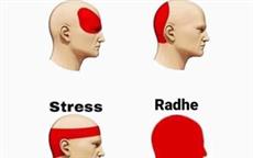 Radhe Headache