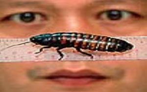 Teen left horrified after doctors discover 26 cockroaches inside right ear
