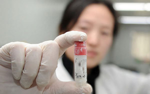 Call for men in China: Your Nation Needs Your Sperm