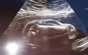 Bizarre Ultrasound pic shows couple pregnant with 'Sports Car'