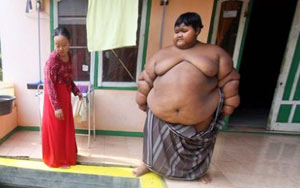 Meet World's Fattest Child Weighs 192 Kg. at Just 10 Years of Age