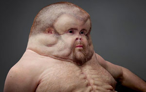 Meet Graham, The Only Man Who Can Survive A Fatal Car Crash