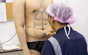 This Thai Hospital Gives You Instant Six-Pack Abs