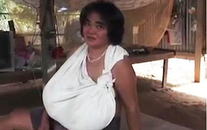 Mysterious Condition Causes Middle-Aged Woman's Breasts to Grow Uncontrollably