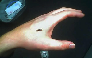 Man Implants Car Key in Hand to His Unlock Tesla with a Simple Wave