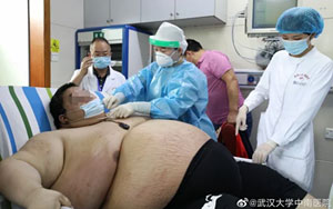 Chinese Man Gains 100Kg During Five-Month Lockdown