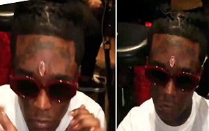 US Rapper Lil Uzi Vert Gets Pink Diamond Worth Rs $24 million Implanted Into His Forehead
