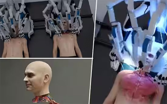 World's First Head Transplant System: US-Based Startup's Spine-Chilling, Graphic video Shocks Internet