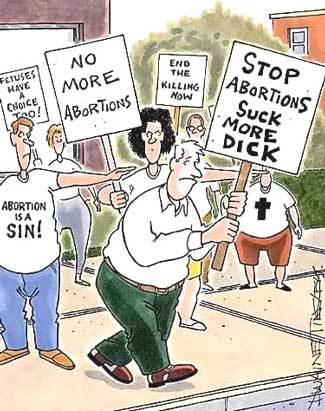 Abortion 'Sucks'!