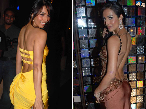 Malaika Arora Khan