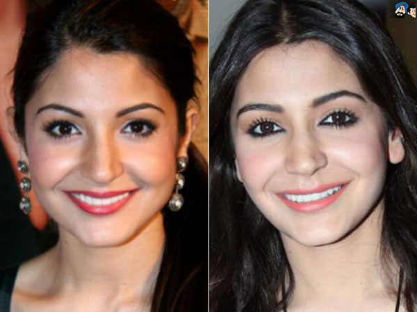 Anushka Under Knife?