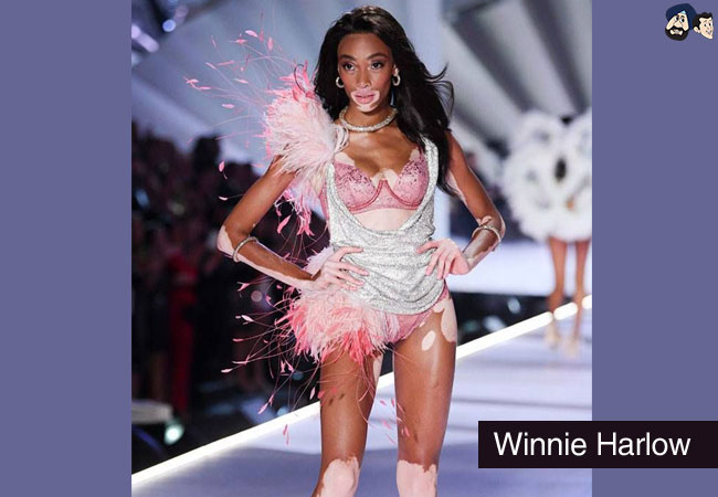 Winnie Harlow