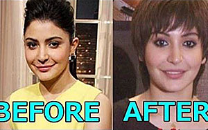 Mystery Behind Anushka's Lips