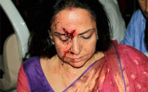 Fans PROTEST Hema Malini For Road Accident 