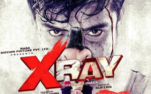 X-RAY Movie Trailer